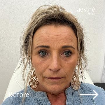 Deze foto's zijn van Aesthé Clinics Hengelo
