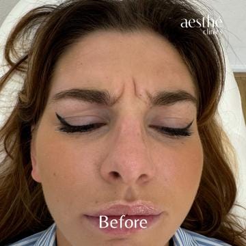 Deze foto's zijn van Aesthé Clinics Hengelo