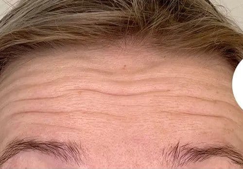 Deze foto's zijn van Ivy clinics Westervoort