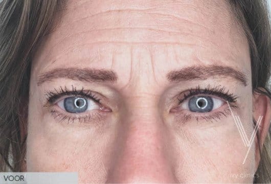 Deze foto's zijn van Ivy clinics Den Bosch