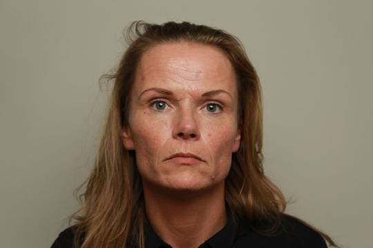 voorfoto-liquid-facelift-+-botox-vrouw-2-detail